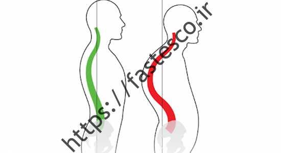 با چند حرکت ساده قوز را در خانه درمان کنید