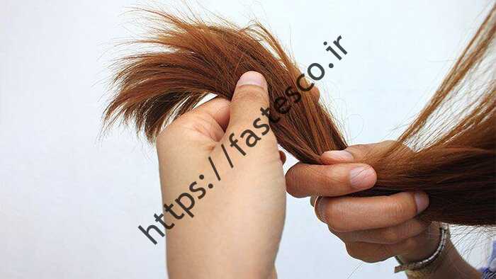5 برای حفظ سلامت موهای زائد